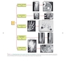 Orthopaedic Imaging: A Practical Approach (Orthopedic Imaging a Practical Approach) Seventh Edition