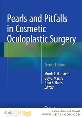 Pearls and Pitfalls in Cosmetic Oculoplastic Surgery 2nd ed
