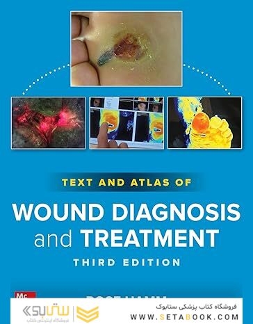 Text and Atlas of Wound Diagnosis and Treatment, Third Edition