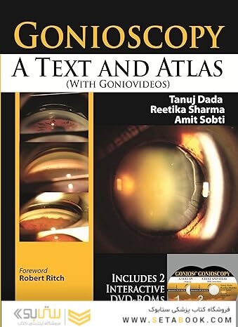 Gonioscopy: A Text and Atlas 1st Edition