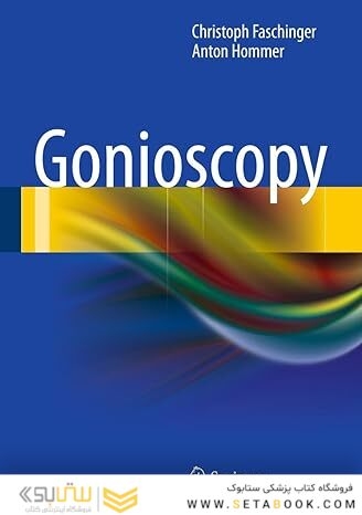 Gonioscopy 2012th Edition