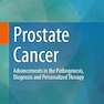 Prostate Cancer: Advancements in the Pathogenesis, Diagnosis and Personalized Therapy