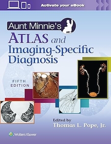 عکس Aunt Minnie’s Atlas and Imaging-Specific Diagnosis