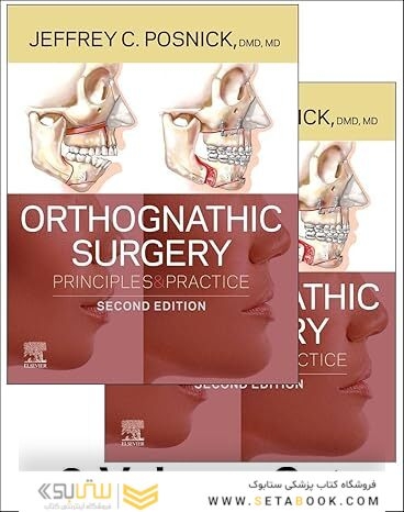 Orthognathic Surgery - 2 Volume Set: Principles and Practice 2nd Edition
