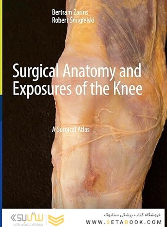 Surgical Anatomy and Exposures of the Knee: A Surgical Atlas
