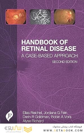 Handbook of Retinal Disease: A Case- Based Approach 2nd Edition