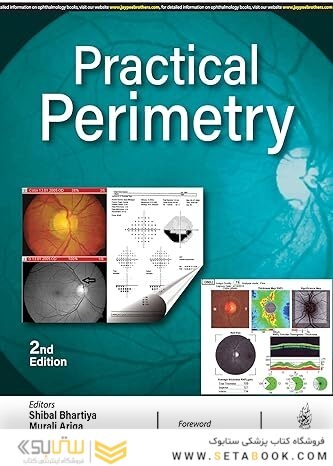 Practical Perimetry