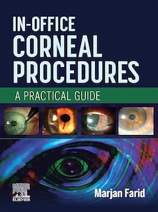 عکس In-Office Corneal Procedures: A Practical Guide