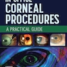 In-Office Corneal Procedures: A Practical Guide