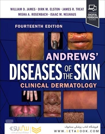 Andrews