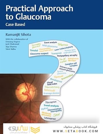 Practical Approach to Glaucoma: Case Based 1st Edition