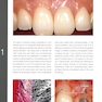 Mucogingival Esthetic Surgery Around Implants 1st Edition