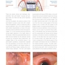 Mucogingival Esthetic Surgery Around Implants 1st Edition