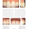 Mucogingival Esthetic Surgery Around Implants 1st Edition