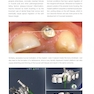 Mucogingival Esthetic Surgery Around Implants 1st Edition