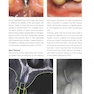 Mucogingival Esthetic Surgery Around Implants 1st Edition