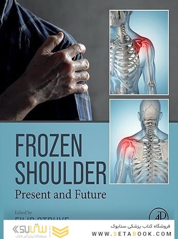 Frozen Shoulder: Present and Future
