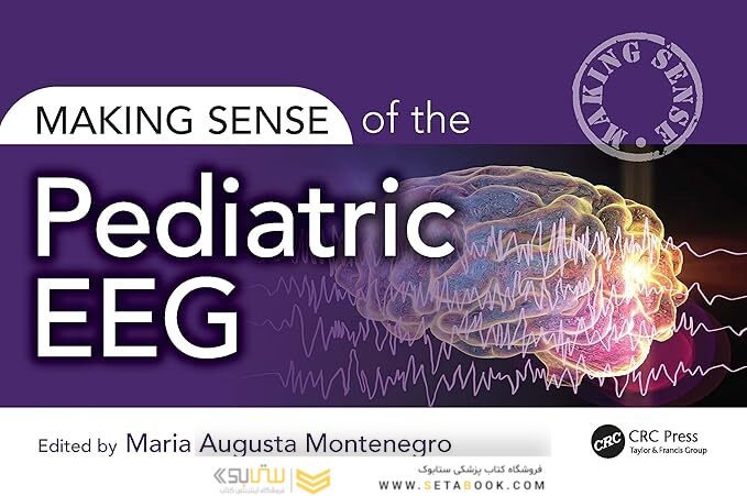 Making Sense of the Pediatric EEG 1st Edition