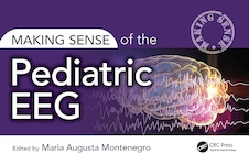 عکس Making Sense of the Pediatric EEG 1st Edition