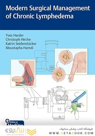 Modern Surgical Management of Chronic Lymphedema 1st Edition