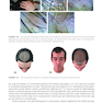 Hair Loss and Restoration 3rd Edition