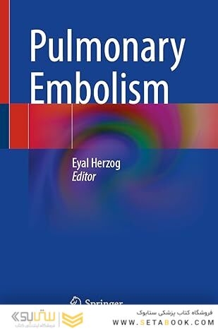 Pulmonary Embolism 1st ed. 2022 Edition