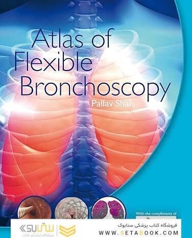 Atlas of Flexible Bronchoscopy 1st Edition
