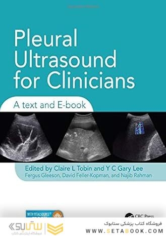 Pleural Ultrasound for Clinicians
