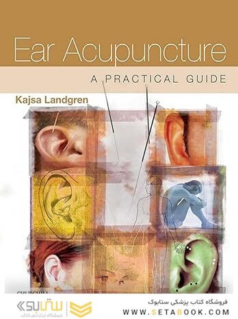 Ear Acupuncture: A Practical Guide