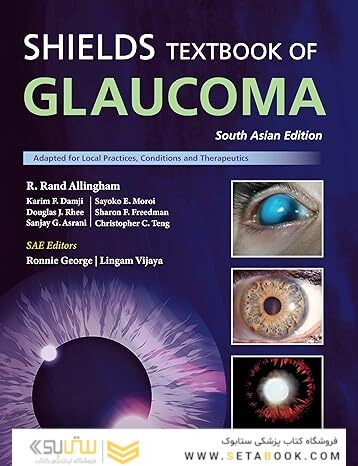 Shield’s Textbook of Glaucoma
