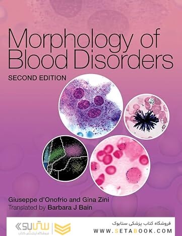 Morphology of Blood Disorders 2nd Edition