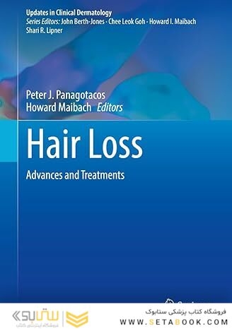 Hair Loss: Advances and Treatments (Updates in Clinical Dermatology)