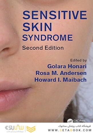 Sensitive Skin Syndrome 2nd Edition