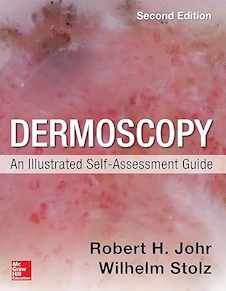 عکس Dermoscopy: An Illustrated Self-Assessment Guide,2nd Edition