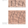 Atlas of Trichoscopy: Dermoscopy in Hair and Scalp Disease