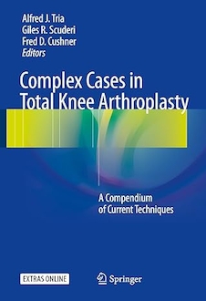 عکس Complex Cases in Total Knee Arthroplasty: A Compendium of Current Techniques 1st ed