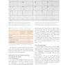Cardiac Pacing and ICDs