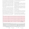 Cardiac Pacing and ICDs
