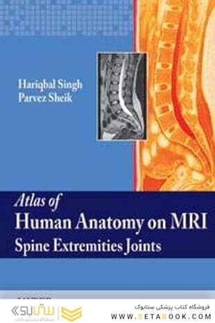 Atlas of Human Anatomy on MRI: Spine Extremities Joints 1st Edition