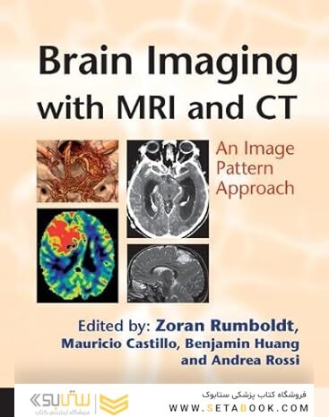 Brain Imaging with MRI and CT: An Image Pattern Approach 1st Edition
