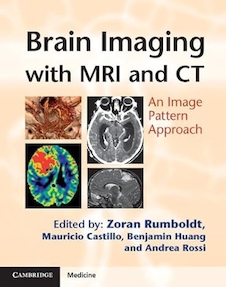 عکس Brain Imaging with MRI and CT: An Image Pattern Approach 1st Edition