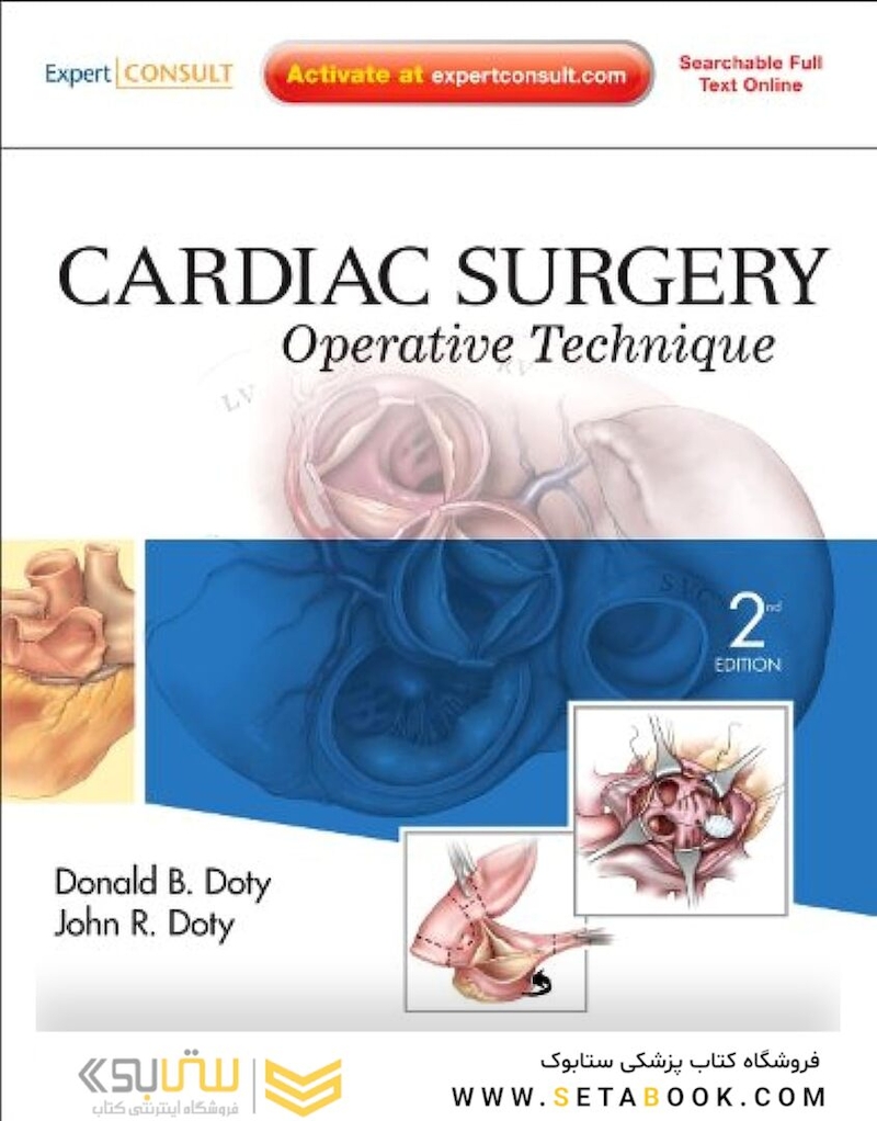 Cardiac Surgery 2nd Edition