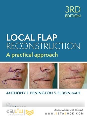 Local Flap Reconstruction, 3rd Edition