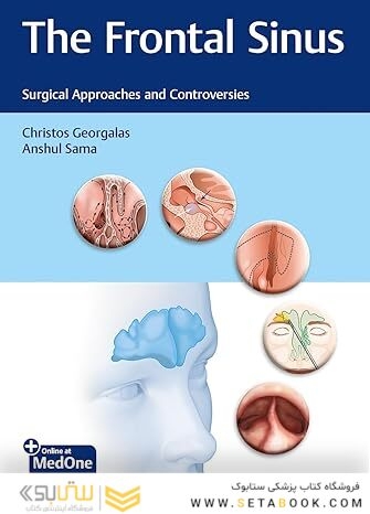 The Frontal Sinus: Surgical Approaches and Controversies 1st Edition