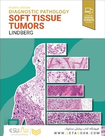 Diagnostic Pathology: Soft Tissue Tumors 4th Edition