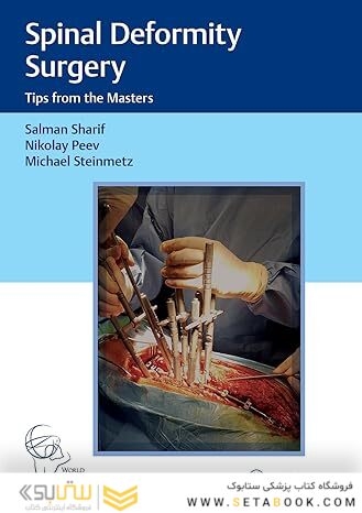 Spinal Deformity Surgery: Tips from the Masters 1st Edition
