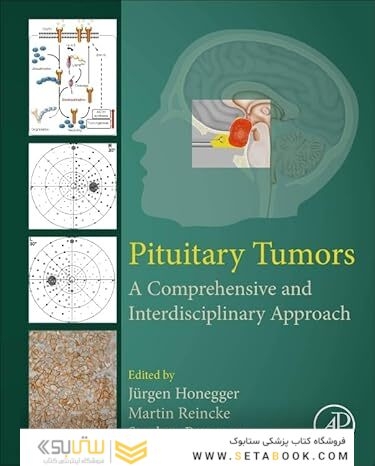 Pituitary Tumors: A Comprehensive and Interdisciplinary Approach 1st Edition