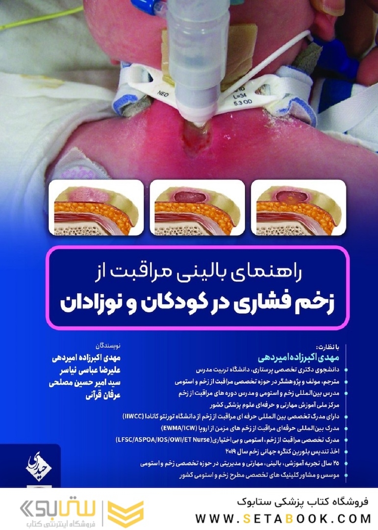 راهنمای بالینی مراقبت از زخم فشاری در کودکان و نوزادان