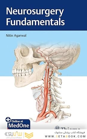 Neurosurgery Fundamentals 1st Edition