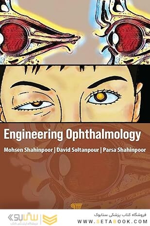 Engineering Ophthalmology 1st Edition